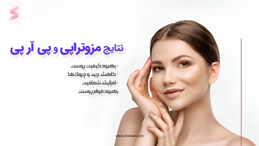 نتایج مزوتراپی و پی آر پی